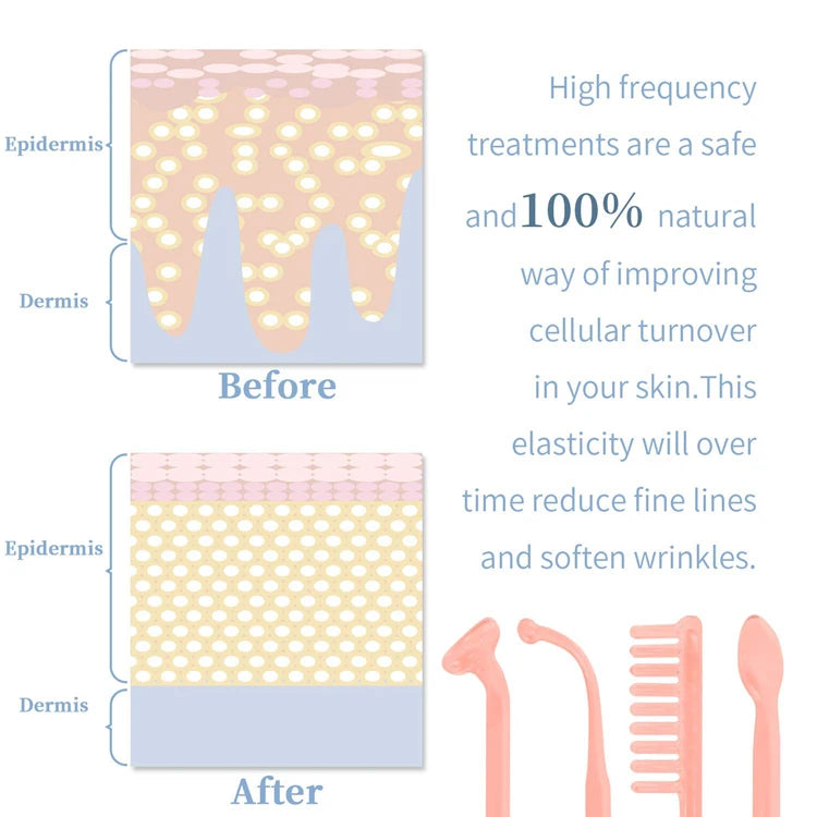 Botavie Skin™ Acne Control & Skin Renewal