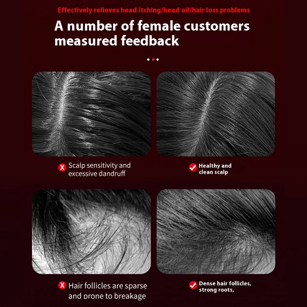 Botavie Skin™ Hair & Scalp Therapy Comb