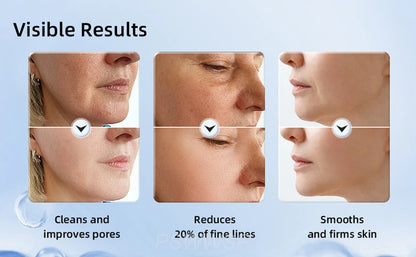 Botavie Skin™ Micro Toner